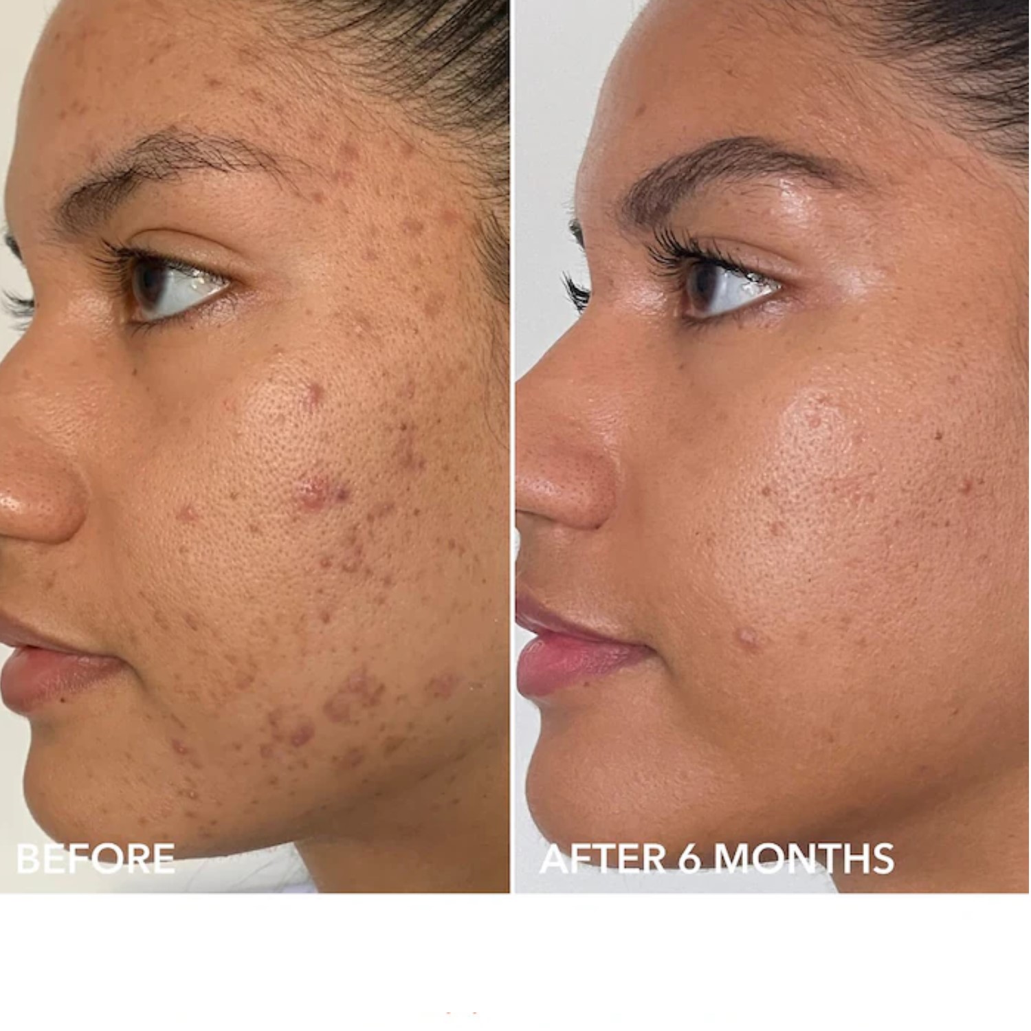 ALPHA BETA EXTRA STRENGTH DAILY PEEL  (ALMOHADILLAS EXFOLIANTES DIARIAS EXTRAFUERTES)